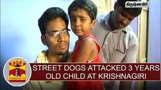 10 Street dog attacked 3 years old child at Krishnagiri, People request to take necessary action