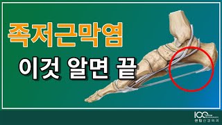 [청주 센텀신경외과]족저근막염 이것만 알면 끝이다,족저근막염운동,발바닥통증,족저근막염스트레칭