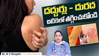 దురదకు పరిష్కారం || Skin Allergy Home Remedies In Telugu || Urticaria Causes || Sankhya Hospitals