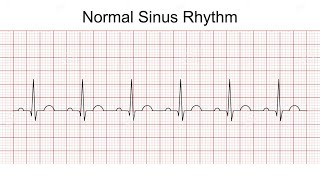 ASSESSMENT \u0026 DIAGNOSTICS 121: Measuring Heart Rhythm, Liver Yin Deficiency, Chills \u0026 Fever