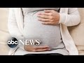 New Study Says Pregnancy Changes the Brain