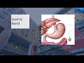 weight loss surgery q u0026a gastric band