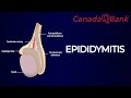 Epididymitis