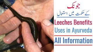 Leech Therapy (Jonk) Benefits | Leeches Use In Ayurvedic Medicines