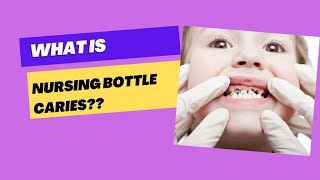 What is Nursing Bottle Caries in Kids? Tips 💡for prevention