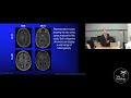 artificial intelligence in radiology from machine learning to clinical application