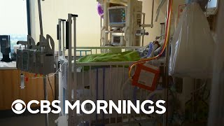 School children in U.S. more than twice as likely as kids in U.K. to end up in hospital with COVID