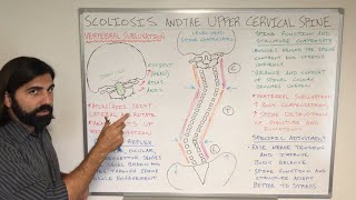 Scoliosis and the Upper Cervical Spine