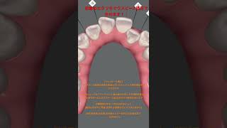 3月12日インビザラインのシュミレーション動画です