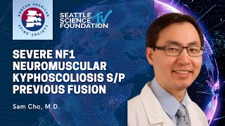 Severe NF1 Neuromuscular Kyphoscoliosis s/p Previous Fusion - Sam Cho, M.D.