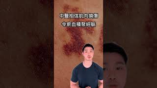 【中醫教你】復健該冷敷還是熱敷？