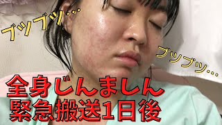 【閲覧注意】緊急搬送から1日後…病態はいかに…？【悲報】