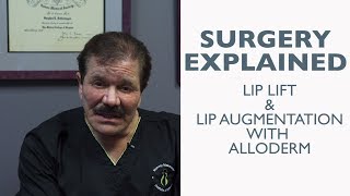 Dr. Schlesinger Explains Lip Lift and Augmentation with Alloderm - Not Graphic