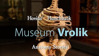 Museum Vrolik - Anatomy Stories 2: Hovius' Hunchback