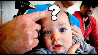 CUTE BABY with a BULGING FONTANELLE (Extremely Rare) | Dr. Paul