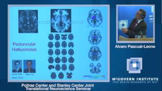 Alvaro Pascual Leone: Stanley Center and Poitras Center Joint Translational Neuroscience Seminar