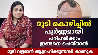 ഹെയർ ട്രാൻസ്‌പ്ലാന്റ്  ശസ്ത്രക്രിയ അറിയേണ്ടതെല്ലാം, Hair Transplant Procedure what to expect \u0026 More​