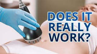 Ultrasonic Cavitation| Weight Loss Transformation  | Does it Really Work?!?  | MYCHWAY