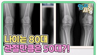 나이는 80대 관절만큼은 50대?! 30년을 회춘한 보고도 믿기지 않은 결과! MBN 230214 방송