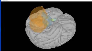 3d visualzation of cortex in Brainstorm