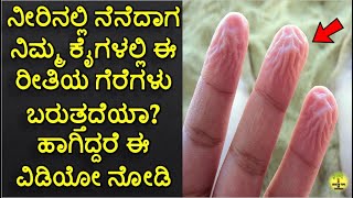 Why do your fingers wrinkle in water |ನೀರಿನಲ್ಲಿ ನೆನೆದಾಗ ನಿಮ್ಮ ಕೈಗಳಲ್ಲಿ ಈ ರೀತಿಯ ಗೆರೆಗಳು ಯಾಕೆ ಬರುತ್ತೆ?