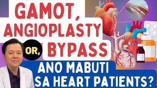 Gamot, Angioplasty OR Bypass: Ano Mabuti sa Heart Patients? - By Doc Willie Ong