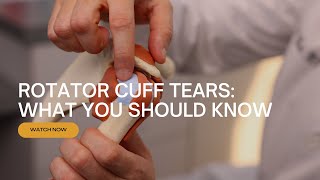 What is a Rotator Cuff Tear? Explained by Dr. Sergio Glait of Orthopaedic Center of South Florida