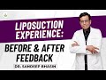 Patient Shares Successful Liposuction Experience: Before & After Feedback | Care Well Medical Centre