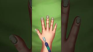 😨😰 Asmr nail complete animation treatment #asmr #shorts #viral #subscribe #share