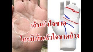 เส้นหัวใจ ขาด ใครมีเส้นหัวใจขาดบ้าง ยกมือขึ้น