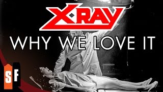 X - Ray - Why We Love It