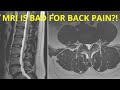 Can an MRI Cause Lower Back Pain? | Research Findings