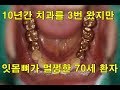 금니하고 십년되도 멀쩡한 이유. 치아를 씌우면 더 빨리 망가지는 건 치과의사 잘못이다. 교합을 잘 맞추면 