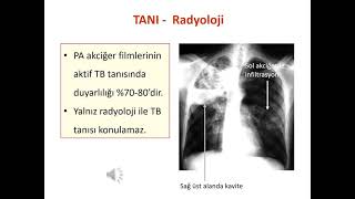 TÜBERKÜLOZ ONLİNE EĞİTİMİ