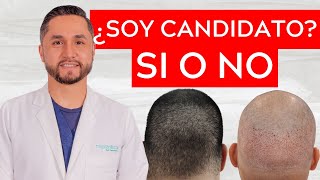 🤔🤯¿Cómo sé si soy CANDIDATO para un INJERTO CAPILAR?