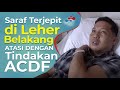 SARAF KEJEPIT DI LEHER BELAKANG ATASI DENGAN TINDAKAN ACDF