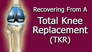 Recovering From A Total Knee Replacement (TKR) Operation