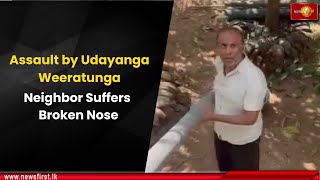 Assault by Udayanga Weeratunga: Neighbor Suffers Broken Nose