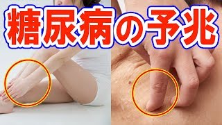 【見逃すな】糖尿病の方に出ると言われる7つの初期症状！カラダに起こるヤバすぎるサインとは？