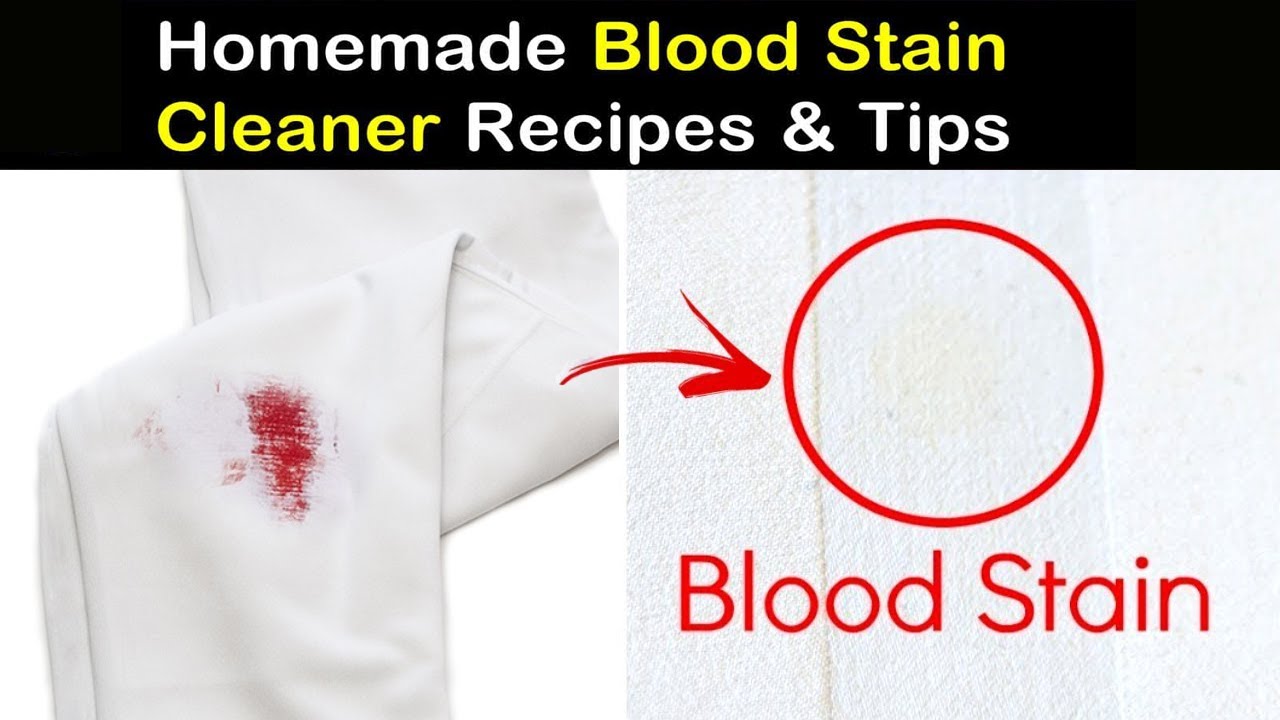 Remove Old And Dried Blood Stains From Clothes, Blanket, Bed, Mattress ...