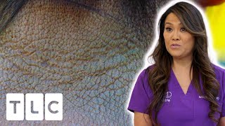 Dr Lee Helps Patient With Atopic Dermatitis | Dr Pimple Popper: This Is Zit