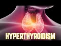 Hyperthyroidism (updated 2023) - CRASH! Medical Review Series