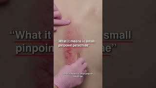 What Is The Meaning Of Gua Sha?