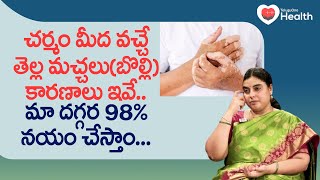 Vitiligo | చర్మం మీద వచ్చే తెల్ల మచ్చలకు కారణాలు ఇవే.. Dr. SGV Sathya | TeluguOne Health