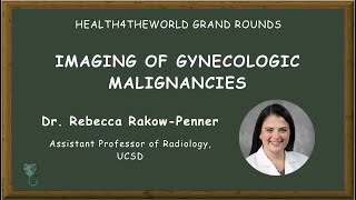 Imaging Gynecologic Malignancies