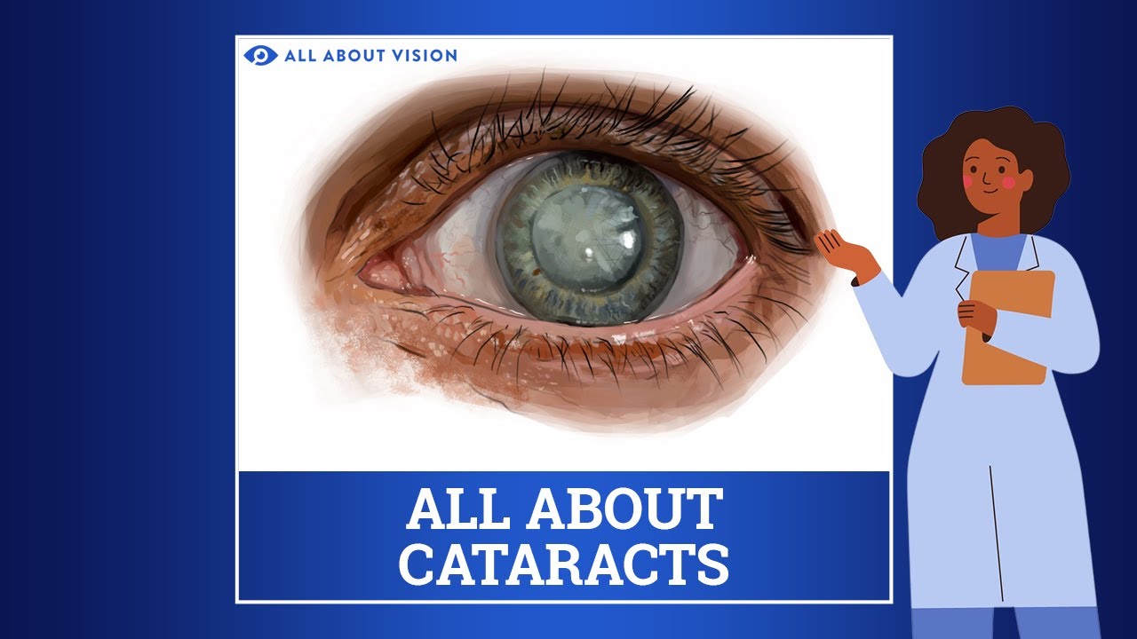 The Disease Of Eye Cataracts