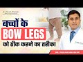 बच्चों के Bow Legs को ठीक करने के बेहतरीन तरीके | Bow legs in babies in hindi