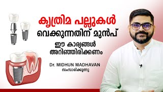 കൃത്രിമ പല്ലുകൾ വെക്കുന്നതിന് മുൻപ് ഈ കാര്യങ്ങൾ അറിഞ്ഞിരിക്കണം | Dental Implants | Health Tips