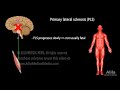 motor neuron disease animation