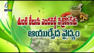 Ayurveda treatment for AVN Hip | Sukhibhava | 18th January 2023 | ETV Andhra Pradesh